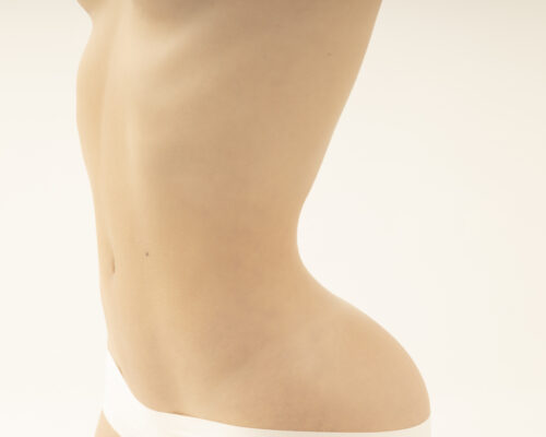 marcacion abdominal marcacion abdominal