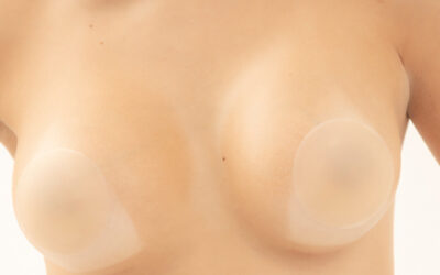 Aumento mamario natural con Preservé: una técnica que cuida tu cuerpo y tu esencia